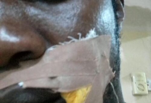 Imansuaghon, ADC Candidate, Okonofua Escape Death In Gun Attack  – THISDAYLIVE