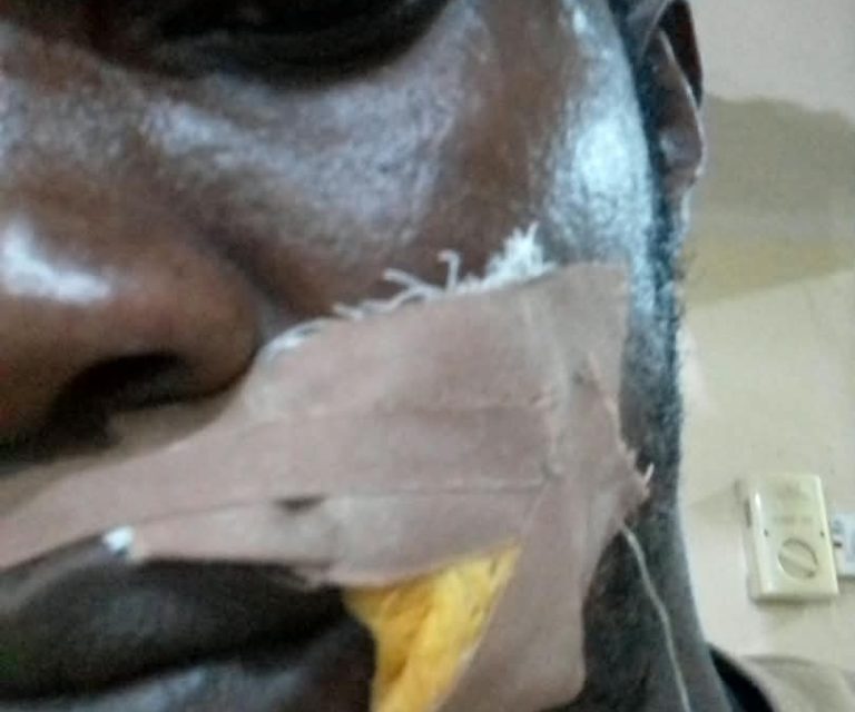 Imansuaghon, ADC Candidate, Okonofua Escape Death In Gun Attack  – THISDAYLIVE